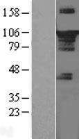 STAT3 Protein - Western validation with an anti-DDK antibody * L: Control HEK293 lysate R: Over-expression lysate