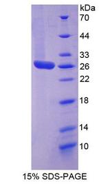 STAT3 Protein - Recombinant  Signal Transducer And Activator Of Transcription 3 By SDS-PAGE