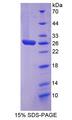 STAT3 Protein - Recombinant  Signal Transducer And Activator Of Transcription 3 By SDS-PAGE