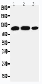 STAT4 Antibody - WB of STAT4 antibody. All lanes: Anti-STAT4 at 0.5ug/ml. Lane 1: Rat Testis Tissue Lysate at 40ug. Lane 2: U87 Whole Cell Lysate at 40ug. Lane 3: HELA Whole Cell Lysate at 40ug. Predicted bind size: 86KD. Observed bind size: 86KD.