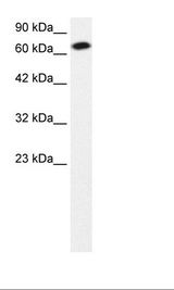 STAT4 Antibody - HepG2 Cell Lysate.  This image was taken for the unconjugated form of this product. Other forms have not been tested.