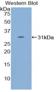 STAT4 Antibody - Western blot of recombinant STAT4.  This image was taken for the unconjugated form of this product. Other forms have not been tested.