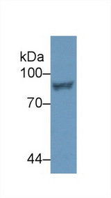 STAT4 Antibody - Western Blot; Sample: Human Jurkat cell lysate; Primary Ab: 2µg/ml Rabbit Anti-Human STAT4 Antibody Second Ab: 0.2µg/mL HRP-Linked Caprine Anti-Rabbit IgG Polyclonal Antibody