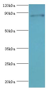STAT4 Antibody - Western blot. All lanes: Signal transducer and activator of transcription 4 antibody at 7 ug/ml+Jurkat whole cell lysate. Secondary antibody: Goat polyclonal to rabbit at 1:10000 dilution. Predicted band size: 86 kDa. Observed band size: 86 kDa.