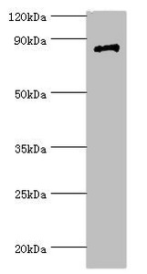 STAT4 Antibody - Western blot All lanes: Signal transducer and activator of transcription 4 antibody at 7µg/ml + Jurkat whole cell lysate Secondary Goat polyclonal to rabbit IgG at 1/10000 dilution Predicted band size: 86 kDa Observed band size: 86 kDa