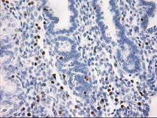 STAT4 Antibody - IHC of paraffin-embedded Human endometrium tissue using anti-STAT4 mouse monoclonal antibody.
