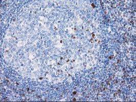STAT4 Antibody - IHC of paraffin-embedded Human lymph node tissue using anti-STAT4 mouse monoclonal antibody.