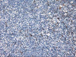 STAT4 Antibody - IHC of paraffin-embedded Human tonsil using anti-STAT4 mouse monoclonal antibody.