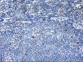STAT4 Antibody - IHC of paraffin-embedded Human lymph node tissue using anti-STAT4 mouse monoclonal antibody. (Heat-induced epitope retrieval by 10mM citric buffer, pH6.0, 100C for 10min).