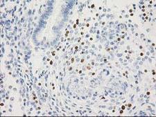 STAT4 Antibody - IHC of paraffin-embedded Human endometrium tissue using anti-STAT4 mouse monoclonal antibody.