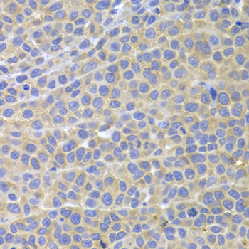 STAT4 Antibody - Immunohistochemistry of paraffin-embedded mouse cancer tissue.