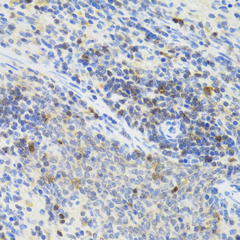 STAT4 Antibody - Immunohistochemistry of paraffin-embedded rat spleen tissue.