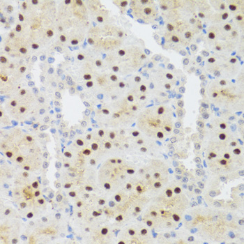 STAT4 Antibody - Immunohistochemistry of paraffin-embedded rat kidney tissue.
