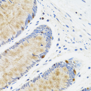 STAT4 Antibody - Immunohistochemistry of paraffin-embedded human rectum tissue.