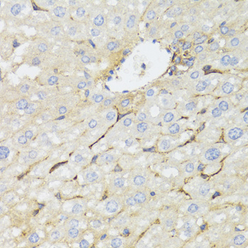 STAT4 Antibody - Immunohistochemistry of paraffin-embedded mouse liver tissue.