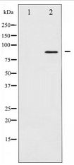 STAT4 Antibody - Western blot of STAT4 expression in HeLa whole cell lysates,The lane on the left is treated with the antigen-specific peptide.