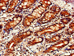 STAT4 Antibody - Immunohistochemistry of paraffin-embedded human small intestine tissue at dilution of 1:100