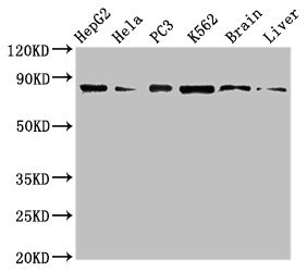 STAT4 Antibody - Western Blot Positive WB detected in:HepG2 whole cell lysate,Hela whole cell lysate,PC3 whole cell lysate,K562 whole cell lyaste,Mouse brain tissue,Rat liver tissue All Lanes:STAT4 antibody at 1µg/ml Secondary Goat polyclonal to rabbit IgG at 1/50000 dilution Predicted band size: 86 KDa Observed band size: 86 KDa