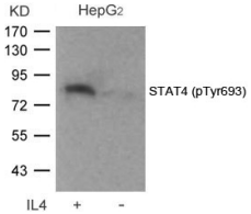 STAT4 Antibody - Detection of STAT4 (phospho-Tyr693) in extracts HepG2 cells treated or untreated with IL-4.