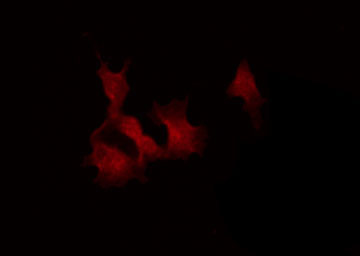 STAT4 Antibody - Staining K562 cells by IF/ICC. The samples were fixed with PFA and permeabilized in 0.1% Triton X-100, then blocked in 10% serum for 45 min at 25°C. The primary antibody was diluted at 1:200 and incubated with the sample for 1 hour at 37°C. An Alexa Fluor 594 conjugated goat anti-rabbit IgG (H+L) Ab, diluted at 1/600, was used as the secondary antibody.