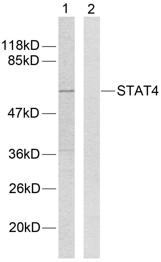 STAT4 Antibody - Western blot analysis of extracts from HeLa cells using STAT4 (Ab-693) antibody.