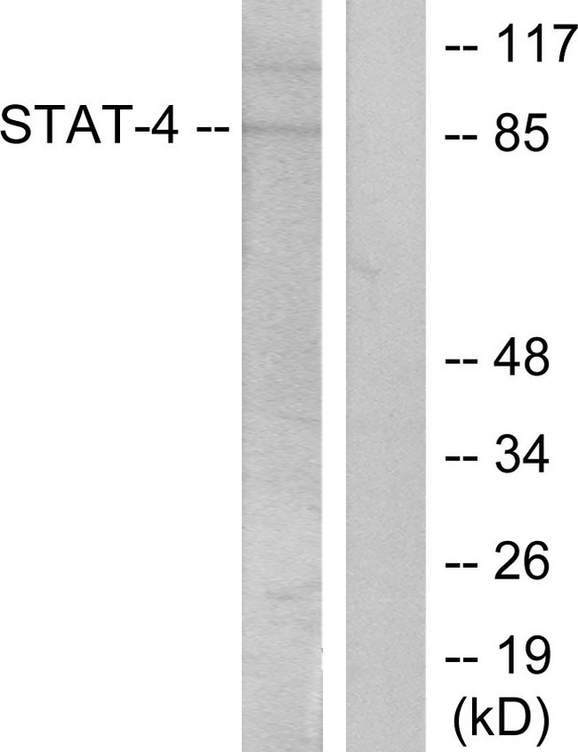 STAT4 Antibody - Western blot analysis of lysates from HeLa cells treated with IL-4, using STAT4 (Phospho-Tyr693) Antibody. The lane on the right is blocked with the phospho peptide.