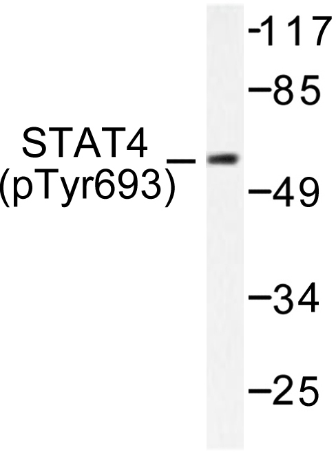 STAT4 Antibody - Western blot of p-STAT4 (Y693) pAb in extracts from HeLa cells.