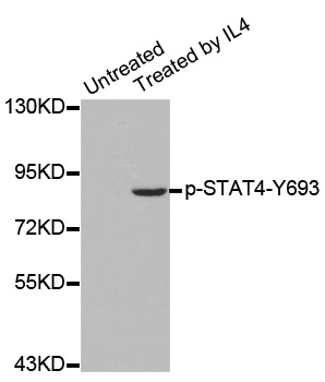STAT4 Antibody - Western blot analysis of extracts from HepG2 cells.