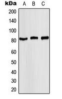 STAT4 Antibody - Western blot analysis of STAT4 (pY693) expression in MCF7 (A); mouse kidney (B); rat kidney (C) whole cell lysates.