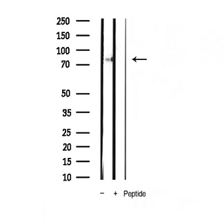 STAT4 Antibody - Western blot analysis of Phospho-STAT4 (Tyr693) expression in mouse heart tissue lysate
