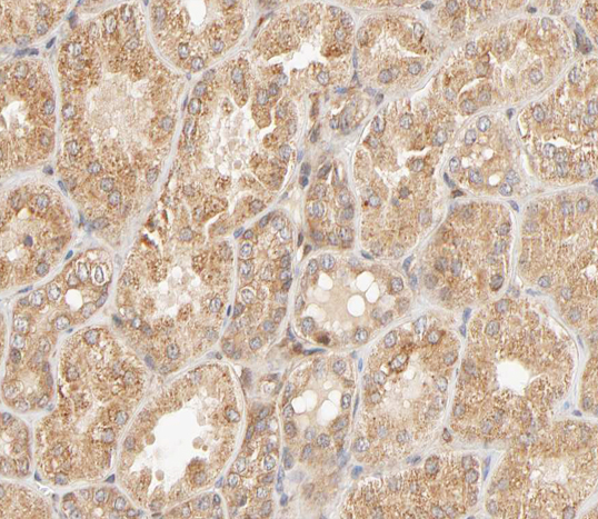 STAT4 Antibody - 1:200 staining human kidney tissue by IHC-P. The tissue was formaldehyde fixed and a heat mediated antigen retrieval step in citrate buffer was performed. The tissue was then blocked and incubated with the antibody for 1.5 hours at 22°C. An HRP conjugated goat anti-rabbit antibody was used as the secondary.