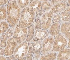 STAT4 Antibody - 1:200 staining human kidney tissue by IHC-P. The tissue was formaldehyde fixed and a heat mediated antigen retrieval step in citrate buffer was performed. The tissue was then blocked and incubated with the antibody for 1.5 hours at 22°C. An HRP conjugated goat anti-rabbit antibody was used as the secondary.