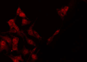 STAT4 Antibody - Staining HeLa cells by IF/ICC. The samples were fixed with PFA and permeabilized in 0.1% Triton X-100, then blocked in 10% serum for 45 min at 25°C. The primary antibody was diluted at 1:200 and incubated with the sample for 1 hour at 37°C. An Alexa Fluor 594 conjugated goat anti-rabbit IgG (H+L) Ab, diluted at 1/600, was used as the secondary antibody.