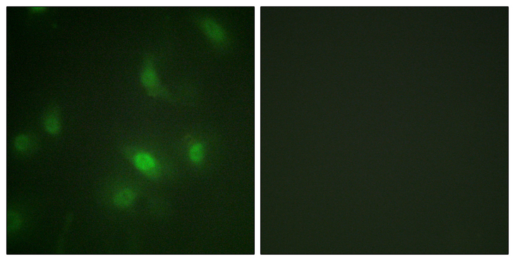 STAT5 A+B Antibody - Immunofluorescence analysis of HepG2 cells, using STAT5A/B (Phospho-Ser725/730) Antibody. The picture on the right is blocked with the phospho peptide.