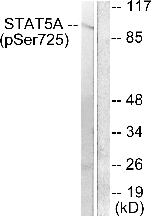 STAT5 A+B Antibody - Western blot analysis of lysates from Jurkat cells treated with EGF 200ng/ml 30', using STAT5A/B (Phospho-Ser725/730) Antibody. The lane on the right is blocked with the phospho peptide.