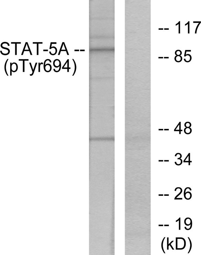 STAT5 A+B Antibody - Western blot analysis of lysates from HeLa cells treated with EGF, using STAT5A (Phospho-Tyr694) Antibody. The lane on the right is blocked with the phospho peptide.