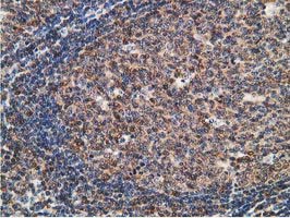STAT5A Antibody - IHC of paraffin-embedded Human lymph node tissue using anti-STAT5A mouse monoclonal antibody.
