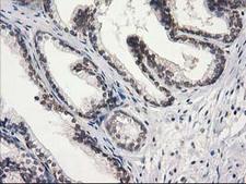 STAT5A Antibody - IHC of paraffin-embedded Human prostate tissue using anti-STAT5A mouse monoclonal antibody.