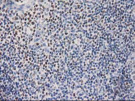 STAT5A Antibody - IHC of paraffin-embedded Human lymph node tissue using anti-STAT5A mouse monoclonal antibody.
