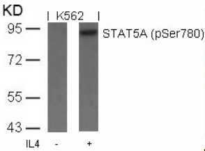 STAT5A Antibody - Detection of STAT5A (phospho-Ser780) in extracts of K562 cells untreated or treated with IL-4.
