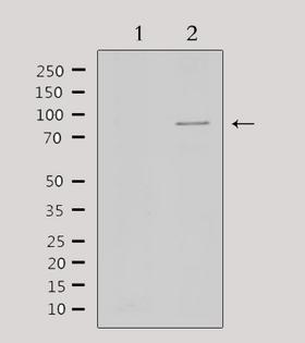 STAT5A Antibody - Western blot analysis of extracts of HepG2 cells using STAT5A/B antibody. Lane 1 was treated with the antigen-specific peptide.