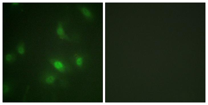 STAT5A Antibody - P-peptide - + Immunofluorescence analysis of HepG2 cells, using STAT5A (Phospho-Ser725) antibody.