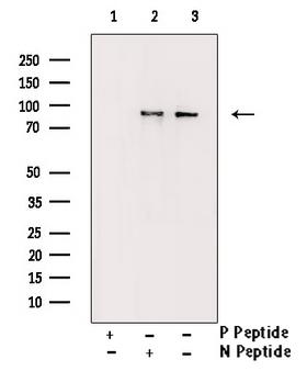 STAT5A Antibody - Western blot analysis of Phospho-STAT5A/B (Ser725/730) antibody expression in EGF treated Jurkat cells lysates. The lane on the right is treated with the antigen-specific peptide.