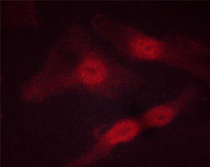 STAT5A Antibody - Staining HeLa cells by IF/ICC. The samples were fixed with PFA and permeabilized in 0.1% saponin prior to blocking in 10% serum for 45 min at 37°C. The primary antibody was diluted 1/400 and incubated with the sample for 1 hour at 37°C. A Alexa Fluor 594 conjugated goat polyclonal to rabbit IgG (H+L), diluted 1/600 was used as secondary antibody.