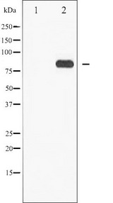 STAT5A Antibody - Western blot analysis of STAT5A/B phosphorylation expression in EGF treated Jurkat whole cells lysates. The lane on the left is treated with the antigen-specific peptide.