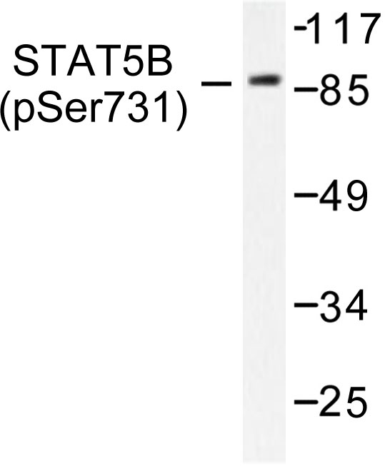 STAT5A Antibody - Western blot of p-Stat5 (S726/731) pAb in extracts from RAW264.7 cells treated with EGF.