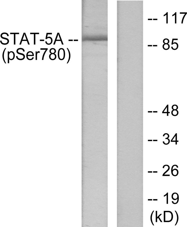 STAT5A Antibody - Western blot analysis of lysates from HeLa cells, using STAT5A (Phospho-Ser780) Antibody. The lane on the right is blocked with the phospho peptide.