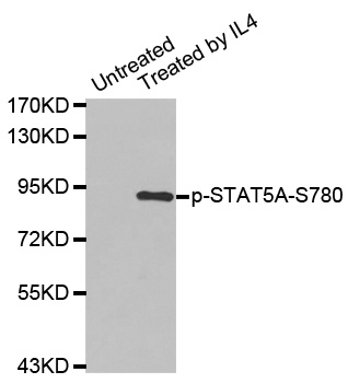 STAT5A Antibody - Western blot analysis of extracts from K562 cells.