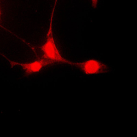 STAT5A Antibody - Immunofluorescent analysis of STAT5A (pS780) staining in HepG2 cells. Formalin-fixed cells were permeabilized with 0.1% Triton X-100 in TBS for 5-10 minutes and blocked with 3% BSA-PBS for 30 minutes at room temperature. Cells were probed with the primary antibody in 3% BSA-PBS and incubated overnight at 4 C in a humidified chamber. Cells were washed with PBST and incubated with a DyLight 594-conjugated secondary antibody (red) in PBS at room temperature in the dark. DAPI was used to stain the cell nuclei (blue).