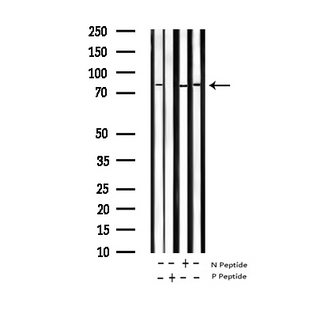STAT5A Antibody - Western blot analysis of Phospho-STAT5A (Ser780) expression in various lysates
